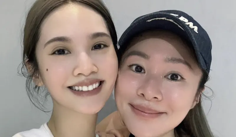 ▲張棋惠（右）今（12）日罕見在公開活動上鬆口好友楊丞琳（左）動刀後病況，坦言她恢復良好，已經可以下床。（圖／張棋惠 臉書）