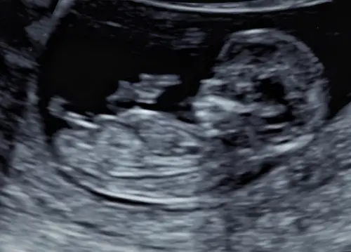 ▲焦凡凡和婁峻碩有喜了。（圖／ 伊弗龐金有限公司提供）