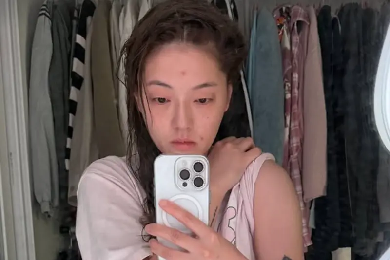 ▲台灣YTR劉力穎（如圖）分享多張瘀青傷勢照，表示她和朋友在韓國拒絕與搭訕的陌生男子一起回家，結果就被當街暴打，甚至手指骨折，她也痛批韓國警察有夠爛。（圖／劉力穎IG@liying0731）