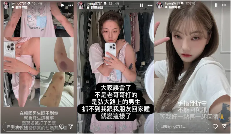    ▲劉力穎日前在社群網路透露自己在韓國因為拒絕搭訕，遭到男子施暴毆打。（圖／劉力穎IG@liying0731）  