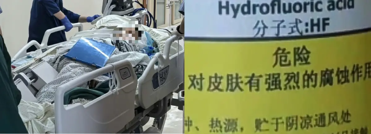 ▲中國杭州一名涂姓女子不慎接觸到廢棄「化骨水」氫氟酸中毒，全身各個臟器功能受損衰竭，送醫搶救後不治身亡。（圖／翻攝自微博）