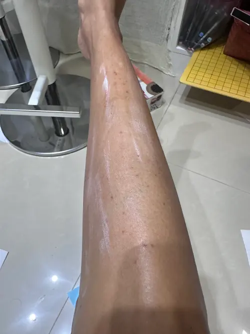 ▲福本幸子透露，有入住前後的照片佐證，還有醫生開的診斷書，直指雲品溫泉酒店就是不乾淨。（圖／福本幸子臉書）