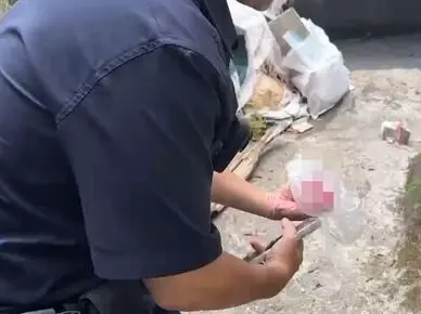 送信途中遇襲！基隆郵差被惡犬攻擊　右手無名指遭咬斷、血流不止
