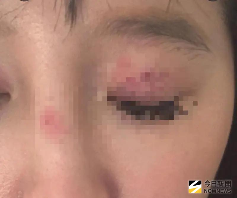 ▲ 20號英國發生台灣人被攻擊事件，25歲陳女被4名青少年暴打，臉部多處受傷。（圖／翻攝畫面）