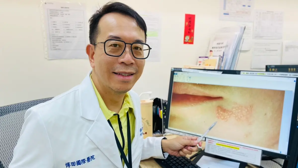 ▲博田國際醫院神經內科醫師陳琮華表示，皰疹Herpes病毒家族的共通點，就是「感染後不肯搬走」，不僅讓醫師診斷棘手，也常讓患者措手不及。（圖／博田國際醫院提供）