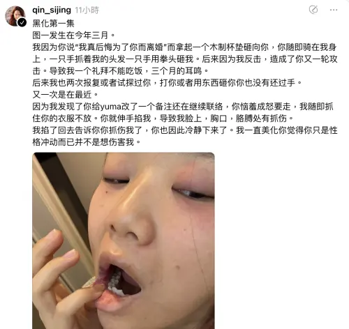 ▲秦思靜控訴Ryu家暴。（圖／翻攝自Threads＠qin_sijing）