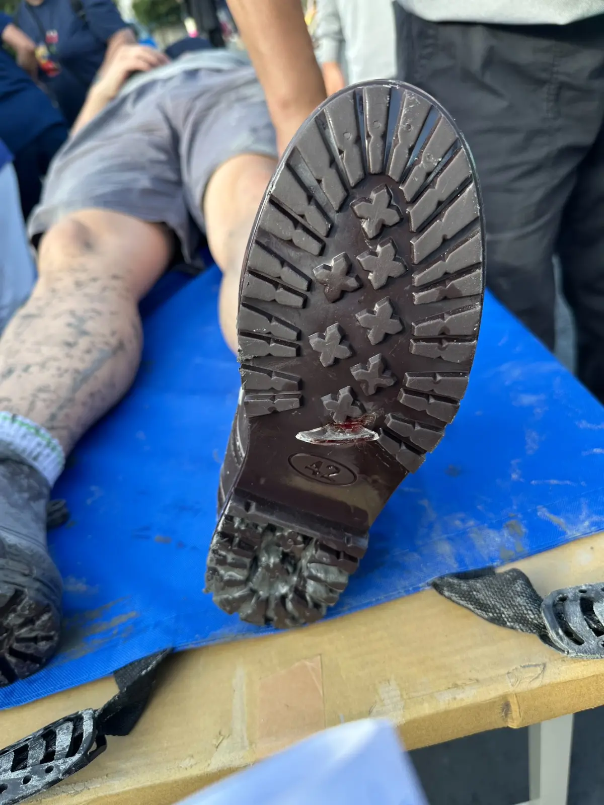 ▲花蓮慈濟醫院這幾天已在災區完成破500例的外科手術，提醒救災人員注意安全，也別忽視自身身體。（圖／取自花蓮慈濟醫院臉書）