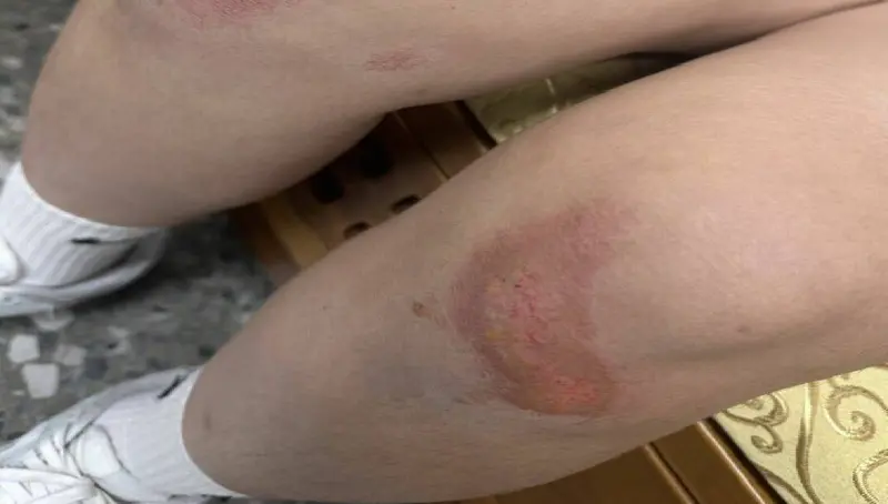 嫌手機太亮！台中少女觀影被男觀眾打到腦震盪　父母怒：告到底！