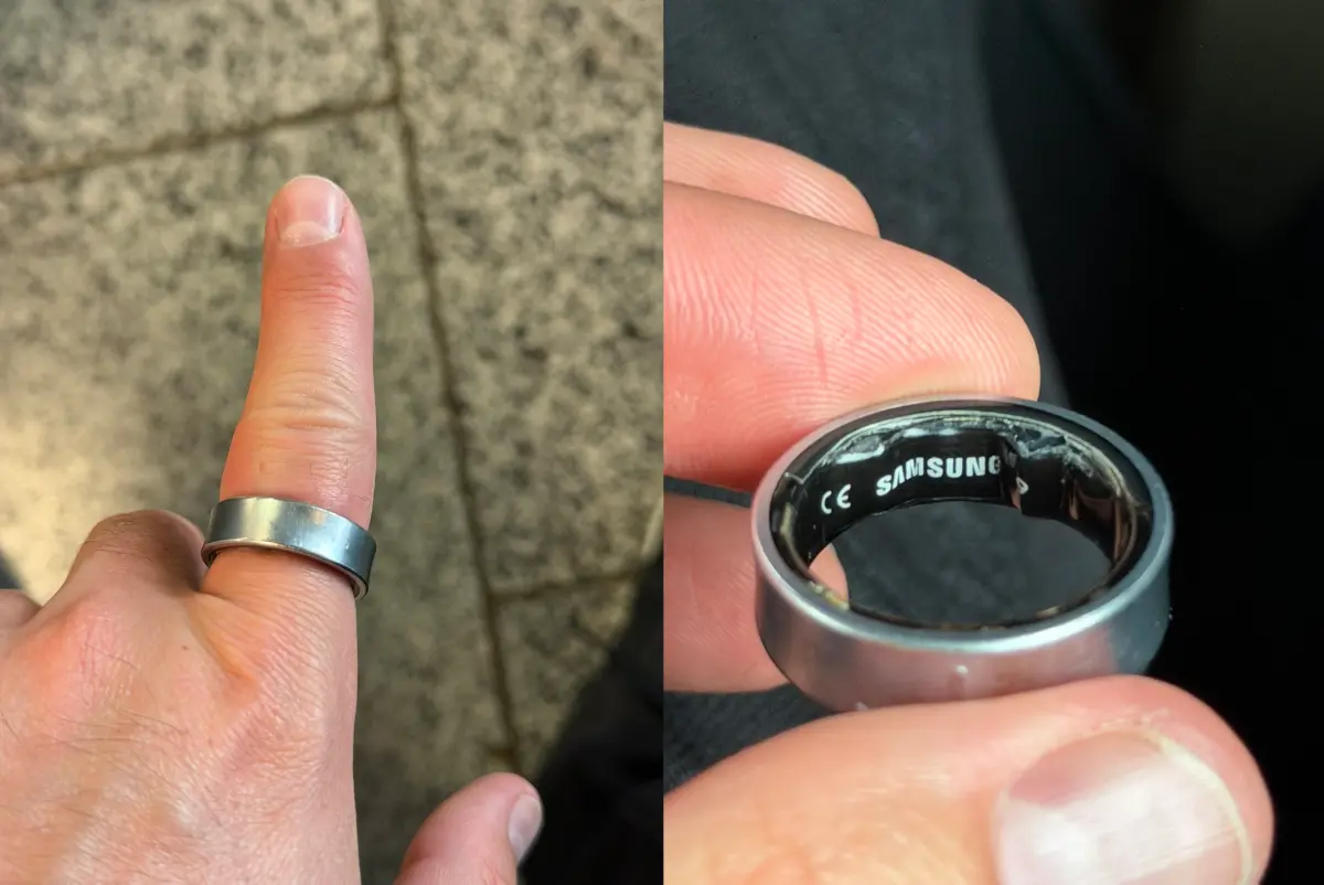 ▲科技網紅洛塔（Daniel Rotar）的三星智慧戒指電池膨脹，卡在手上拿不下來。（圖／翻攝自Ｘ／@ZONEofTECH）