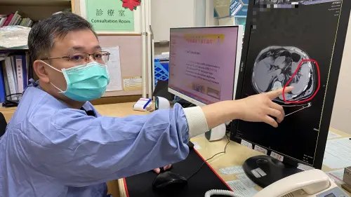 ▲醫師提到，脾臟破裂的症狀可能不明顯，患者未必會立即感覺腹痛，有時僅表現為左胸或左肩疼痛。（圖／員榮醫院提供）