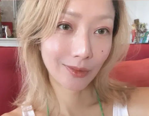 鄭秀文驚傳意外住院！坐在輪椅上表情痛苦　後腰兩處有撕裂傷
