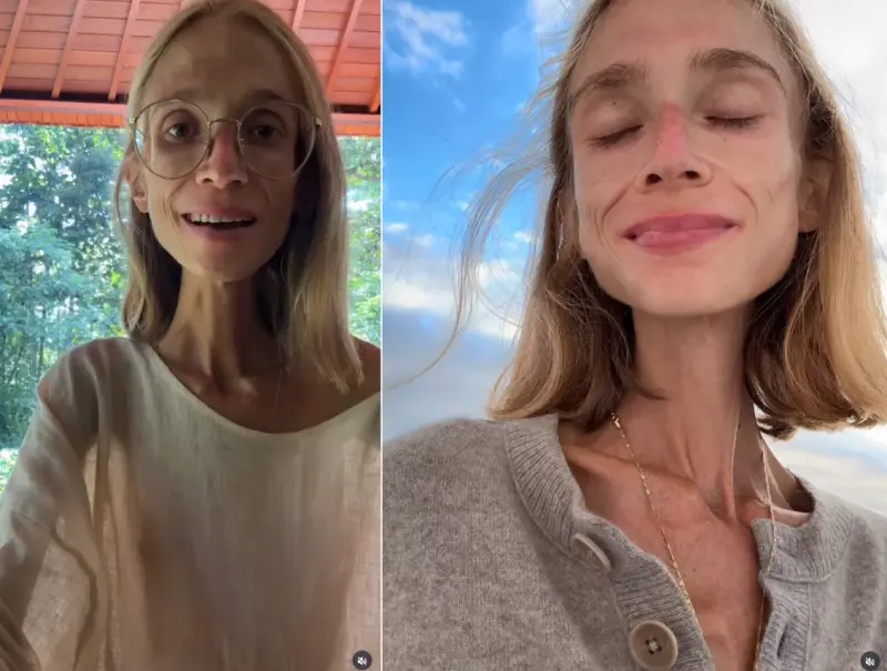 ▲27歲的波蘭女子卡洛琳娜·克日扎克（Karolina Krzyzak）長年奉行只吃水果的果食主義，營養不良不幸去世，生前體重僅剩22公斤。（圖／翻攝自IG／carolina.mariie）