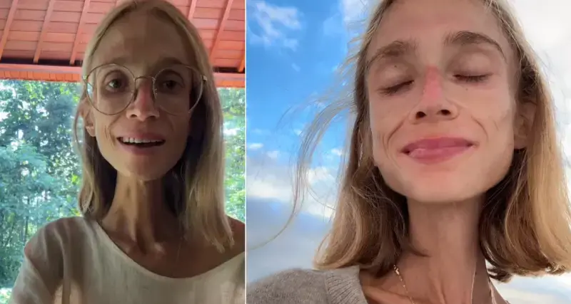 ▲27歲的波蘭女子卡洛琳娜·克日扎克（Karolina Krzyzak）長年奉行只吃水果的果食主義，營養不良不幸去世，生前體重僅剩22公斤。（圖／翻攝自IG／carolina.mariie）