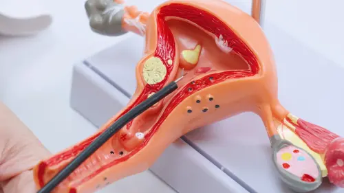 ▲新式赫拉冷刀產品模擬在子宮模型執行手術。（圖／翻攝畫面）