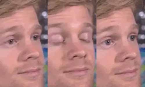 你一定看過他眨眼！「眨眼白人」迷因主角悄行善　替罕病募款千萬
