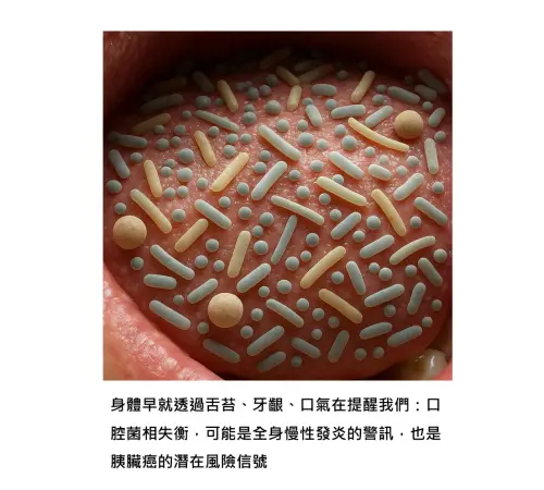 ▲壞菌不但會在牙齦裡作怪，更可能透過血液或淋巴循環，慢慢移動到胰臟，引起局部慢性發炎。（圖／基因醫師張家銘臉書）