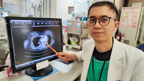 ▲醫師透過溶解血栓的微創醫療技術，加速血栓溶解。（圖／馬偕醫院提供）