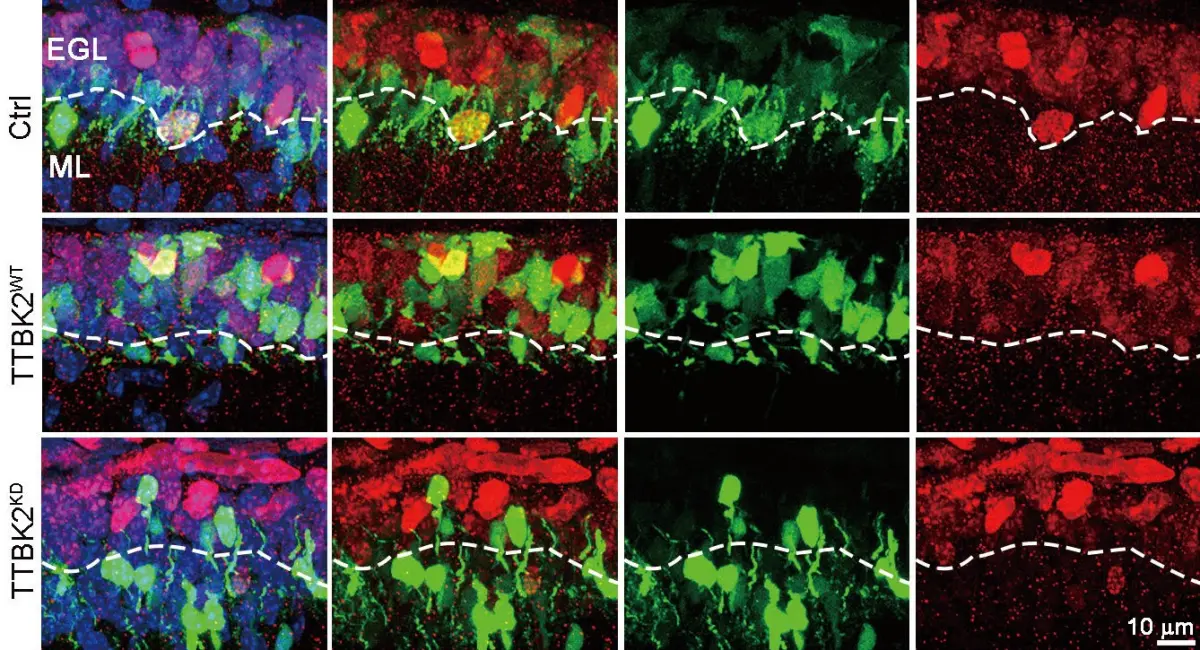 ▲發現TTBK2 的活性能促進小腦顆粒神經前驅細胞（GNP）的增殖，顯示它在腦部發育與疾病中扮演關鍵角色。（圖／陽明交通大學提供）