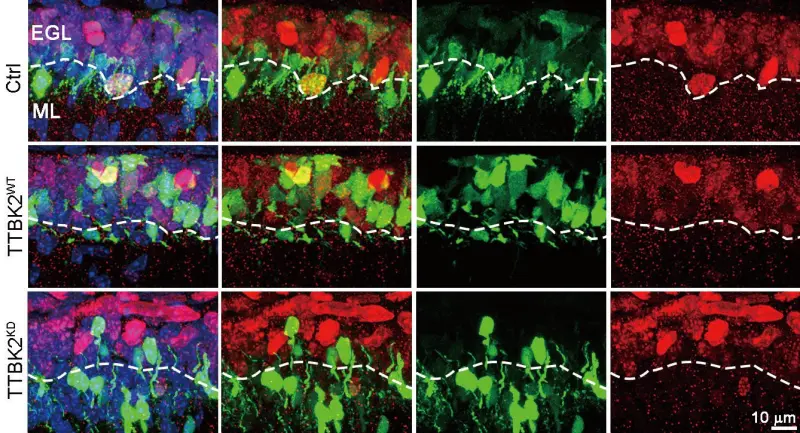 ▲發現TTBK2 的活性能促進小腦顆粒神經前驅細胞（GNP）的增殖，顯示它在腦部發育與疾病中扮演關鍵角色。（圖／陽明交通大學提供）