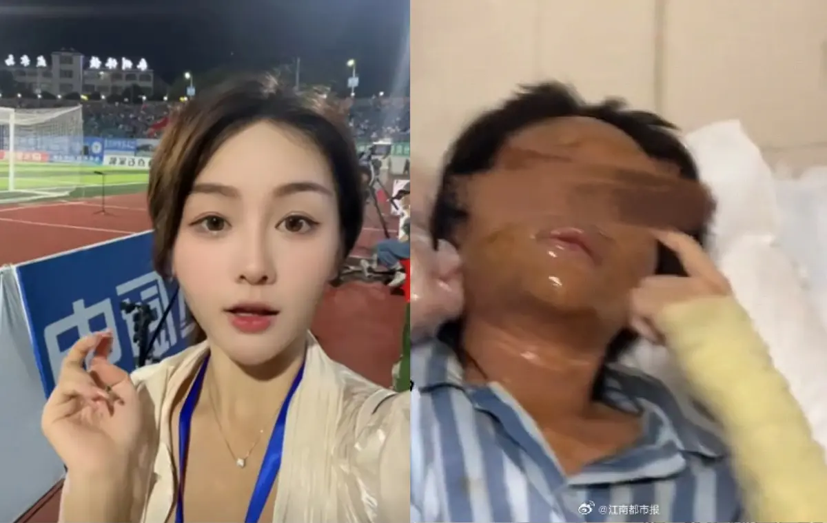 看一眼就爆炸！美女主播遭炸彈包裹「全臉毀容」怪人身影曝