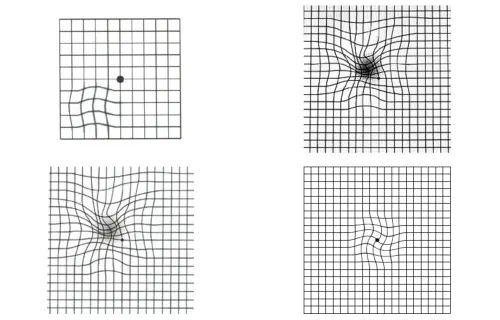 ▲阿姆斯勒方格表。黃斑部病變自我檢測。（圖／翻攝衛福部）
