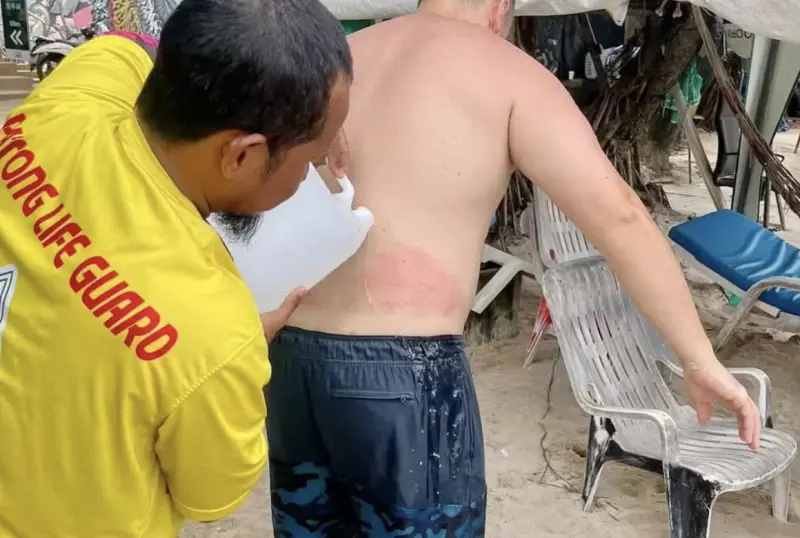 ▲普吉島芭東海灘近日出現多起水母螫人事件，救生員加派人力巡邏並設置警示標誌。（圖／翻攝自Bangkok Post）