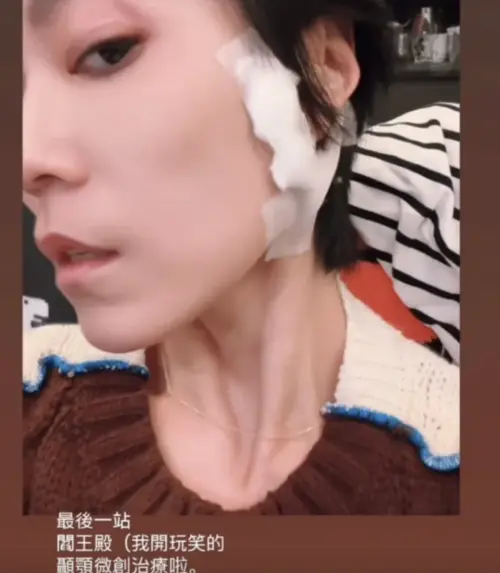 ▲曹雅雯接受治療，開玩笑說最後一站閻王殿。（圖／翻攝自IG@oliviarougejaloux）