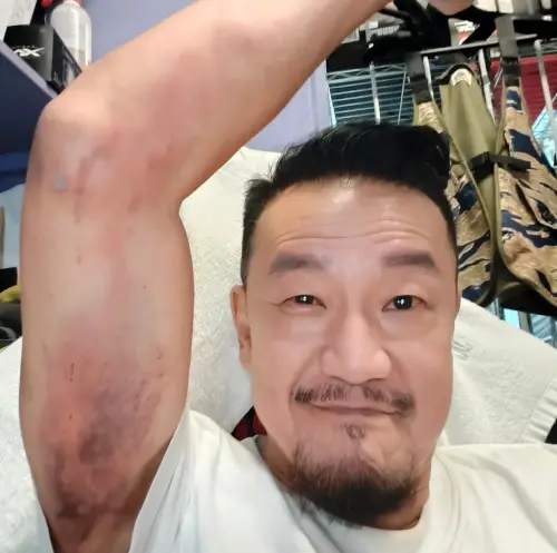 ▲陳為民拍《泥娃娃》瘀青（圖／天予電影提供）