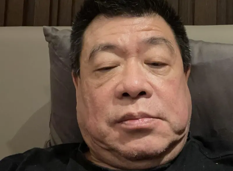 ▲孫德榮（如圖）因為替愛徒于朦朧發聲收到死亡威脅，想不到他近日真的在家出事，他透露自己在家中多次重摔，曬出傷勢照表示差點上西天。（圖／孫腫來了 臉書）