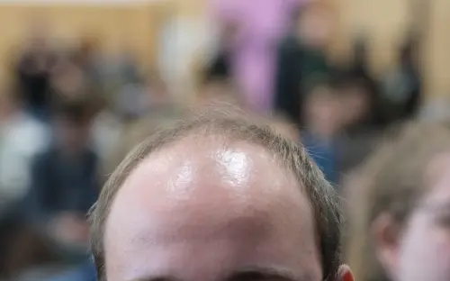 禿頭有救了！台大研究「20天生髮液」1800萬網友喊：保衛台灣
