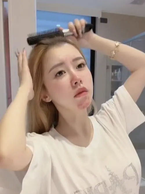 ▲饅頭媽懷孕後臉上狂長痘痘，讓粉絲嚇壞。