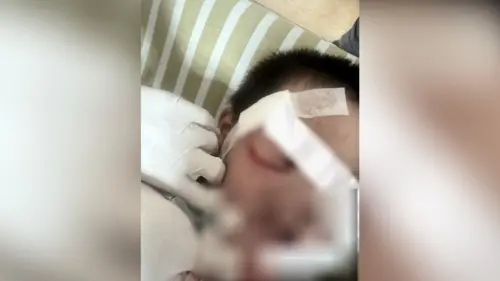 平安宴不平安！嘉義1歲男童遭狗狠咬...嫩臉「皮開肉綻」超心疼

