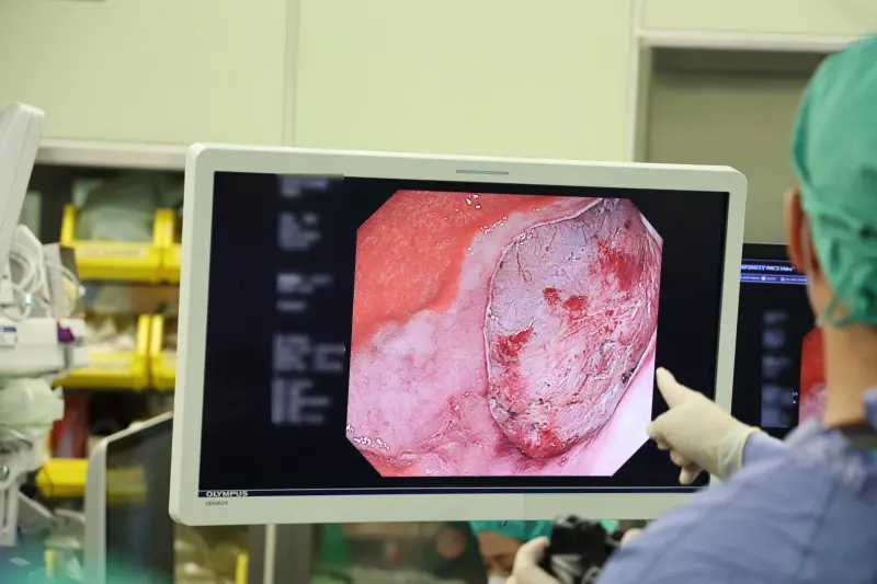 比微創更微創！「肚皮無創手術」切除早期胃癌　術後4小時可喝水