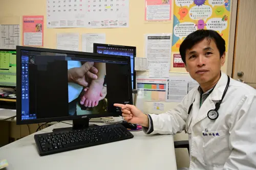 ▲醫師提醒，孩子若出現雙眼結膜充血、口腔黏膜症狀、手腳末端紅腫、多形性皮疹、頸部單側淋巴結腫大等，其中4項症狀就要留意。（圖／亞大附醫提供）