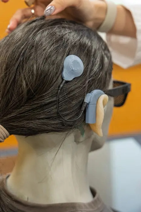 ▲人工耳蝸可將聲音轉為電訊號，直接刺激聽神經，可望有效協助重度聽損者重建聽力。（圖／成大醫院提供）