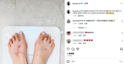 ▲泫雅宣布減肥後火速瘦回4字頭！腳背傷口引擔憂　本人鬆口曝原因。（圖／泫雅IG@hyunah_aa）