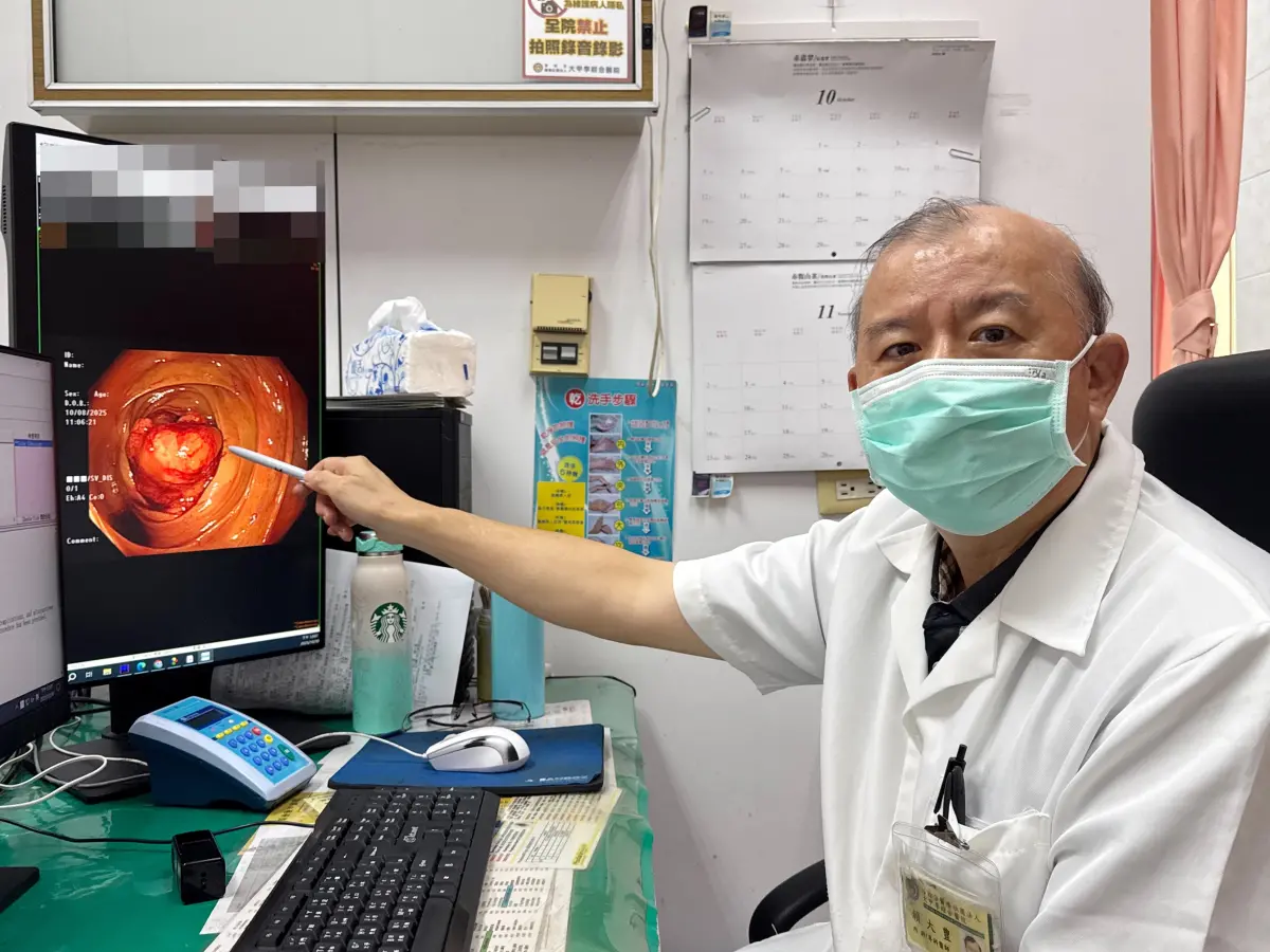 大腸癌連年奪命第一 醫提醒：排便異常別拖延