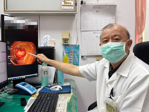 大腸癌連年奪命第一　醫提醒：排便異常別拖延
