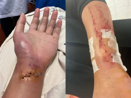 ▲小提琴家陳譽2022年遭惡霸砍傷手，險毀音樂生涯，嫌犯遭判一年半定讞。（圖／陳譽老師．小提琴．鋼琴．創作臉書）