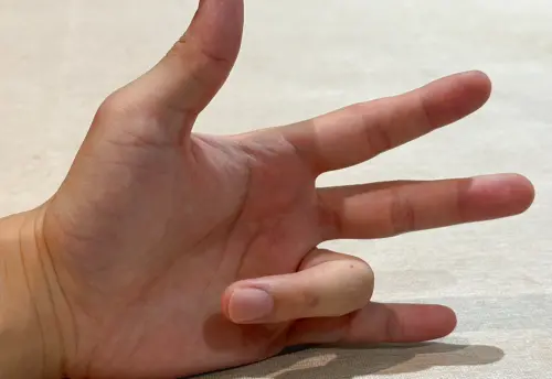 愛折手指50年結果太驚人！醫師、研究早證實　全場傻眼：誤會超久
