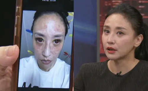 ▲安歆澐（如圖）公開被家暴的照片。（圖／翻攝自YouTube 新聞挖挖哇！）