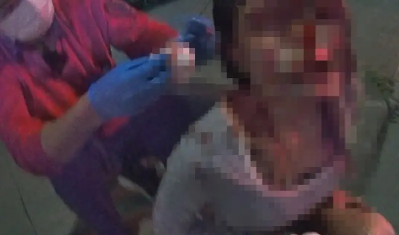 嘉義恐怖自撞車禍！車頭幾乎變形全毀　19歲女子滿臉鮮血緊急送醫