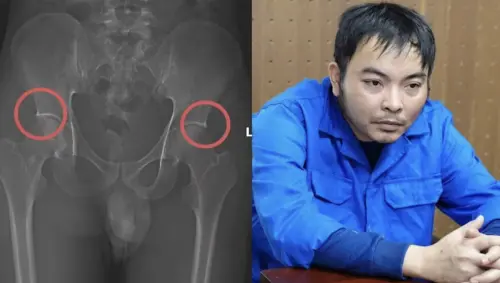 敲碎保戶骨頭詐領保險金！越南前醫護集團騙取逾700萬元
