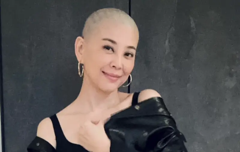 ▲演員方馨（如圖）近期為舞台劇剃光頭，沒想到照片曝光卻掀起熱議，不少網友質疑其假剃，稱方馨頭皮邊緣有皺摺，讓她無奈反擊，怒回：「真的啦！」（圖／方馨 IG @cin_fon）