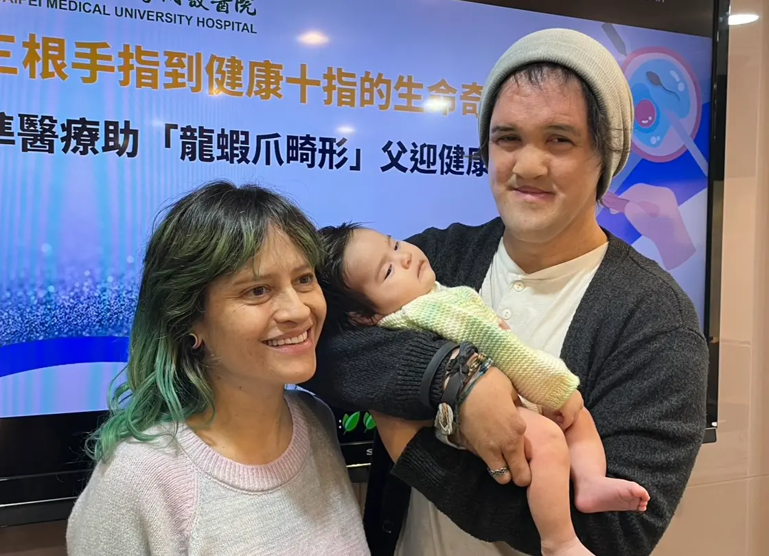終結罕病遺傳！3指爸「龍蝦爪畸形」 精準醫學迎接10指女兒