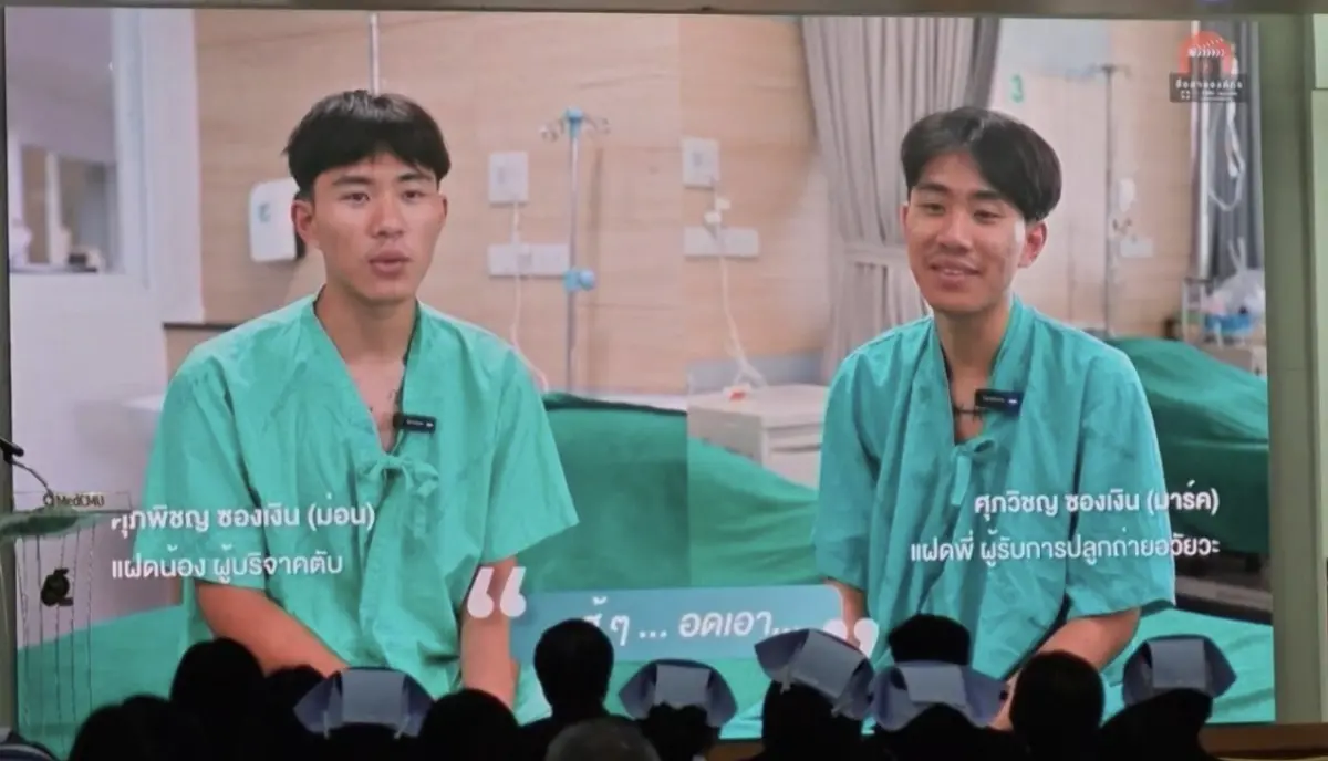 泰國同卵雙胞胎締造醫療里程碑 活體肝臟移植成功救回親兄弟