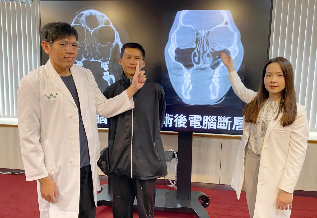 25歲男車禍全臉骨折！玩手遊金幣算不清 醫揭2原因：嚴重創傷