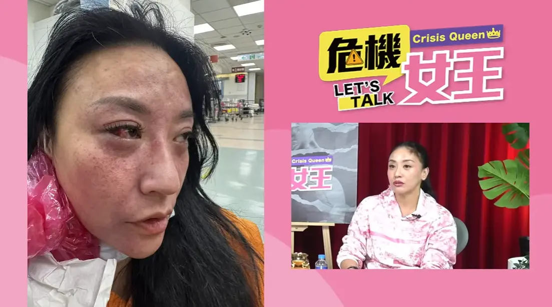 安歆澐發不自殺聲明！被老公勒脖腦缺氧、血管爆裂：再幾秒就沒命