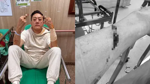 快訊／夜店大亨夏天倫遇襲遭砍1嫌自首　北檢複訊後聲押禁見
