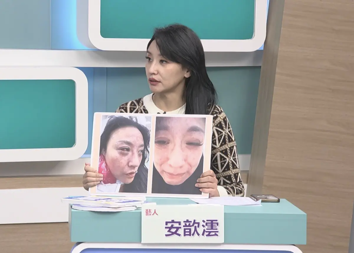 安歆澐險遭老公殺死！拿刀、勒頸場面太可怕 專家呼籲2件事必做